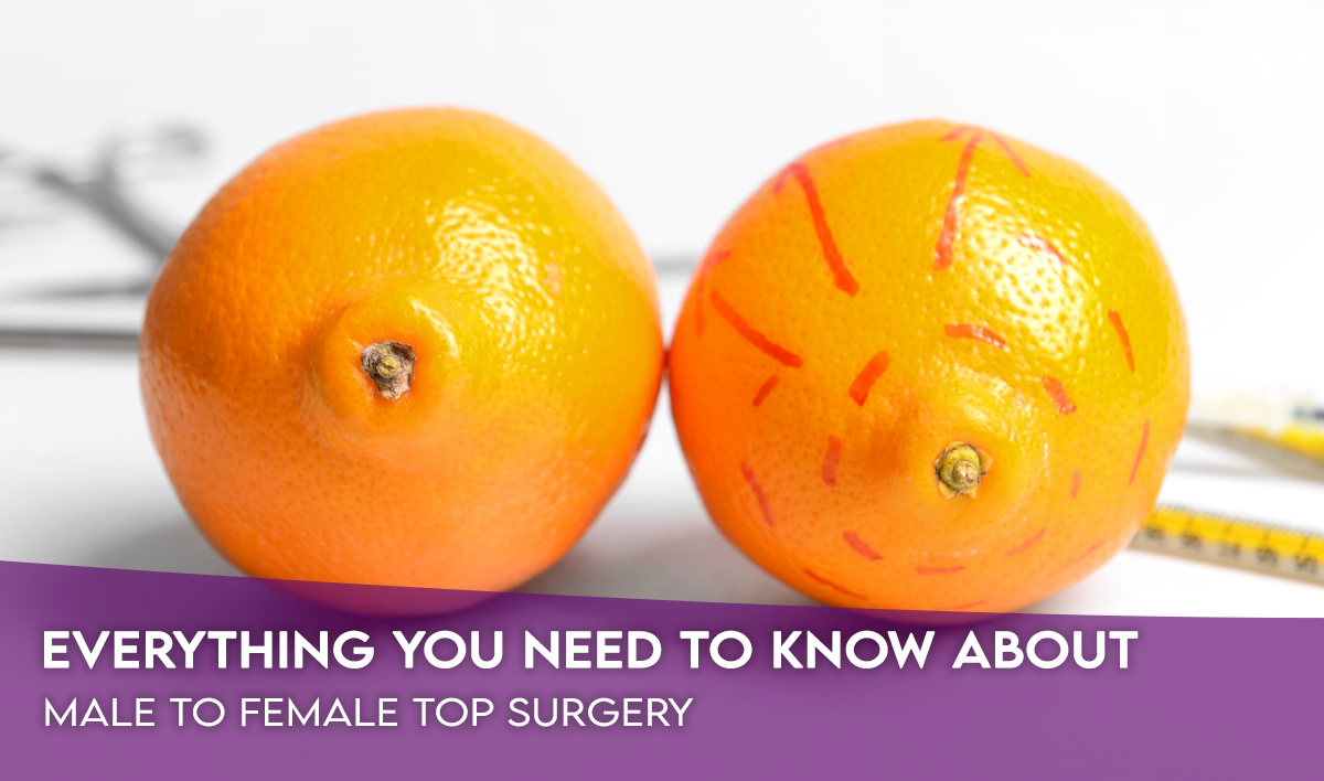 Everything You Need To Know About Male to Female Top Surgery